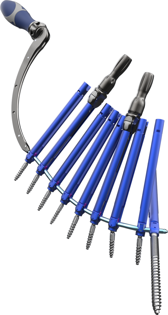 Astura Medical Receives FDA 510(k) Clearance For OLYMPIC MIS Posterior Spinal Fixation System